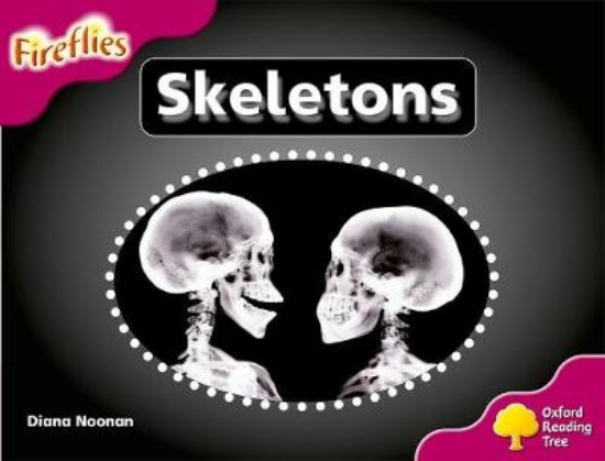 Picture of Skeletons