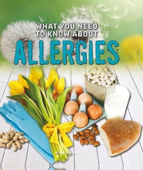 Picture of What You Need to Know about Allergies