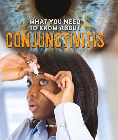 Picture of What You Need to Know about Conjunctivitis