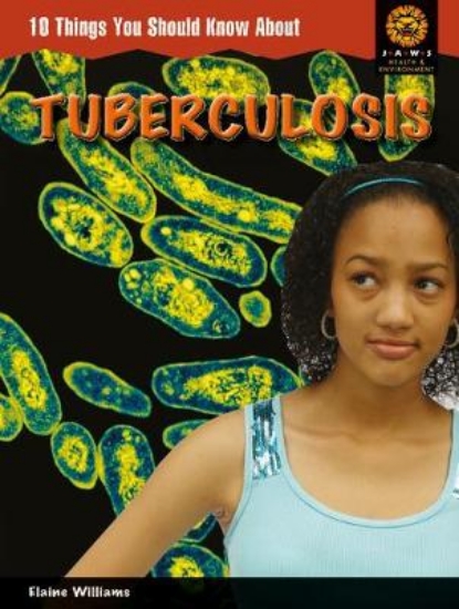 Picture of 10 Things You Should Know About Tuberculosis